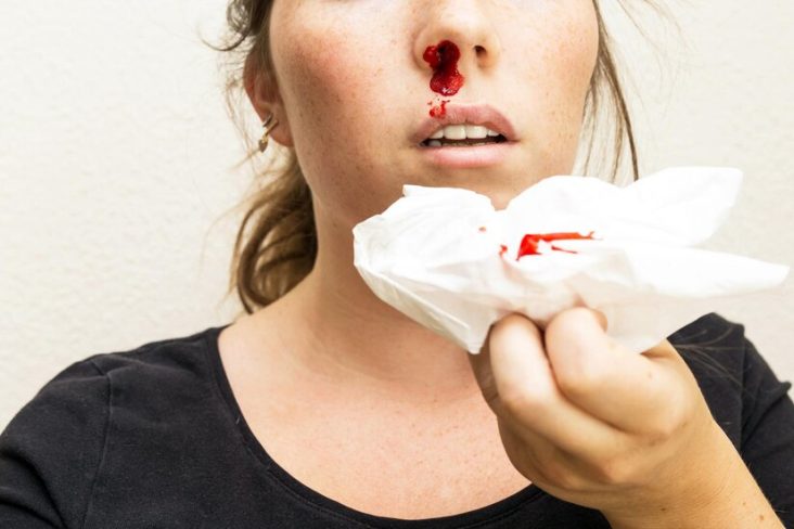 nosebleed woman